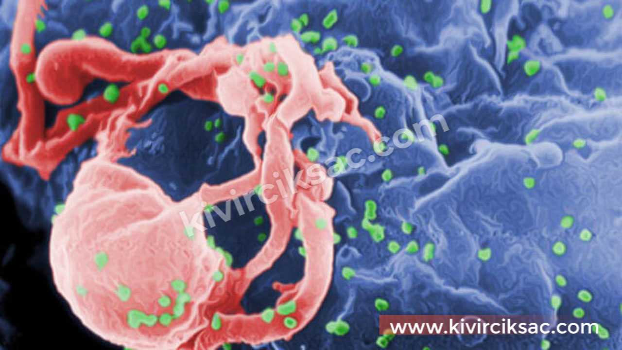 AIDS - HIV Virüsü Tedavi Edilebilir Mi? (Evet)